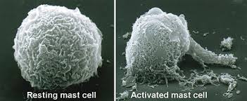 Mast Cell Activation Syndrome (MCAS): What Is Going On Inside My Body?